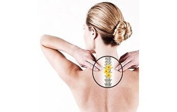 osteocondrose cervical em uma mulher