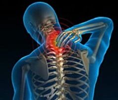 osteocondrose da coluna cervical