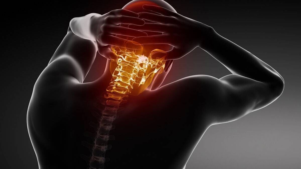 sintomas de osteocondrose cervical