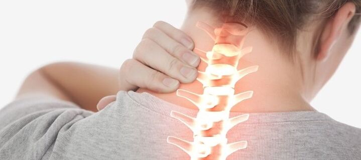 Osteocondrose da coluna cervical, acompanhada de dor no pescoço